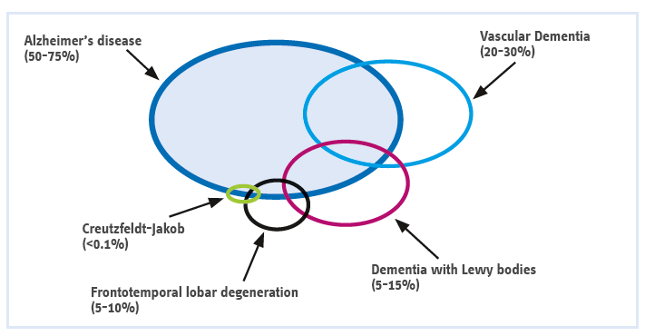 Most frequent neurodegenerative dementias