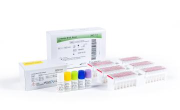 Lumipulse® G NfL CSF | Fujirebio